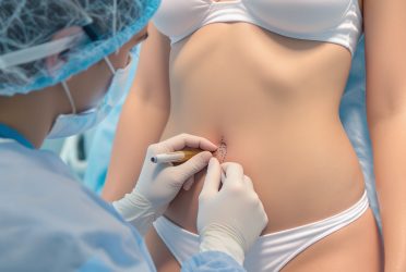 Combining Meso Lipo and EndyMed RF for Body Contouring: Advanced Fat Reduction in Bali